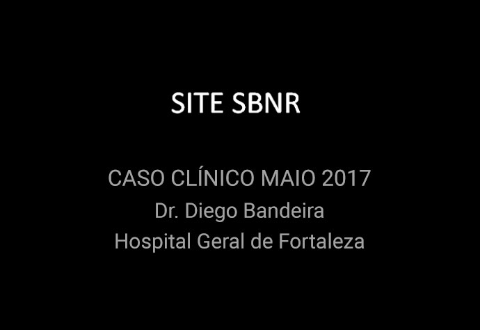 caso